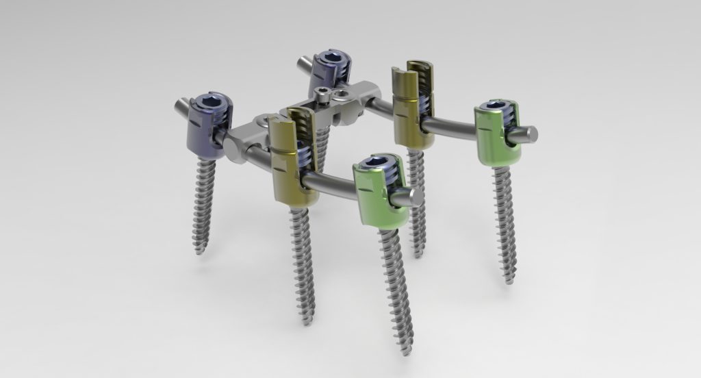 RAPHAEL™ PEDICLE SCREW SYSTEM